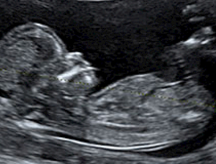 imagen correspondiente a la noticia: "El valor de la vida: reflexiones frente al proyecto de despenalización del aborto"