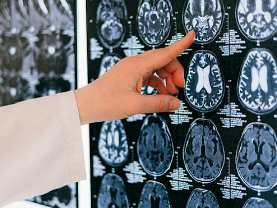 imágenes del cerebro humano