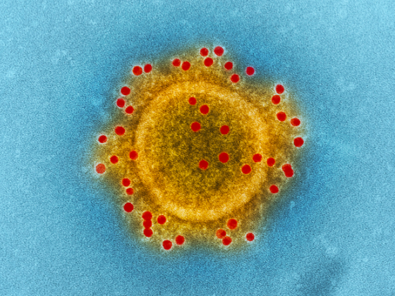 imagen de virus
