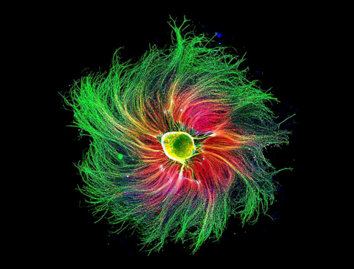 The photo shows a group of rat sensory neurons responsible for detecting painful stimuli in the organism. Image credit: Paula Díaz Céspedes.